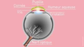 La cataracte