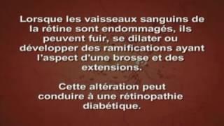 Rétinopathie diabétique: causes et symptomes