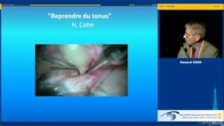 Le glaucome en images - session vidéo (Howard Cohn)