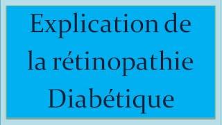 Comment savoir si on est atteint de la Rétinopathie Diabétique