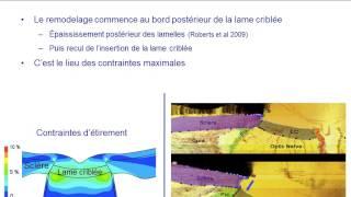 Comment l'œil se déforme dans le glaucome ? Laloum J.