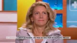 Détecter le cancer du poumon