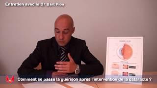 Comment se passe la guérison de la cataracte après l'intervention ?