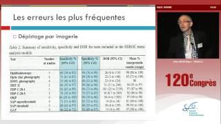 Le dépistage dans la population - L'état de l'art - Glaucome primitif à angle ouvert (Alain Bron)
