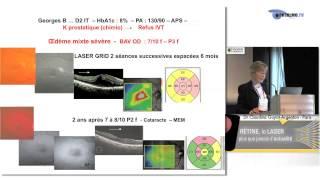 La place du laser et des injections