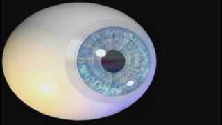 La myopie et l'hypermétropie, expliquées en vidéo
