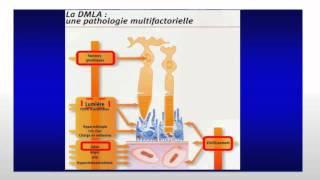 Mardi Santé du 28 octobre 2014 - La DMLA vers de nouvelles perspectives