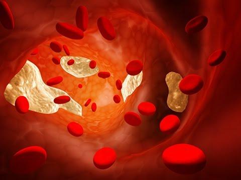 Analyse De Sang : Quel Est Le Taux De Cholestérol Normal ?