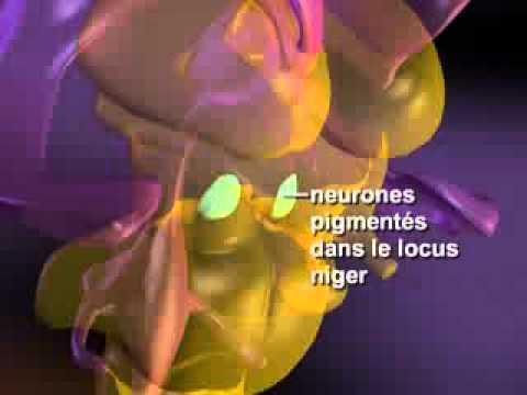 La Maladie De Parkinson